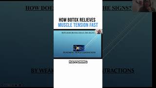 How Botox Relieves Muscle Tension Fast [upl. by Massimiliano808]