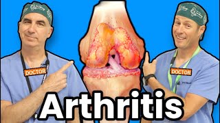 Treating Knee Arthritis Without Surgery [upl. by Ahdar231]