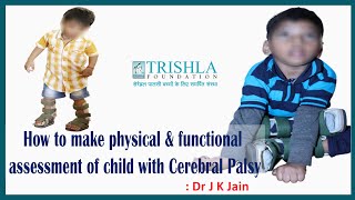 Assessing Physical amp Functional Status of Child with Cerebral Palsy English  Trishla Foundation [upl. by Aelaza]