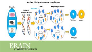 PBA restored GABA uptake and reduced seizures in SLC6A1 patient variantbearing cell amp mouse models [upl. by Schlessel]