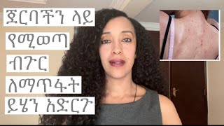 ጀርባችን ላይ የሚወጣ ብጉር ለማጥፋት ይሄን አድርጉ Back acne [upl. by Salkin]