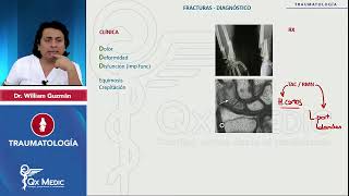 ENAM QxMedic TRAUMATOLOGÍA Fracturas generalidades Diagnóstico [upl. by Adniuqal]