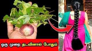 இனி ஒரு முடி கொட்டுனா 100 முடி முளைக்கும் Hair Growth Tips for Forehead in TamilHow To Regrow Hair [upl. by Anoirtac]