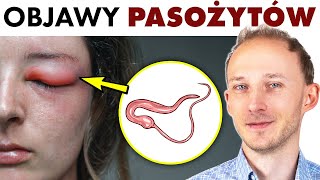 Objawy pasożytów w ciele  i co robić by ich nie złapać  Dr Bartek Kulczyński [upl. by Drofdarb]