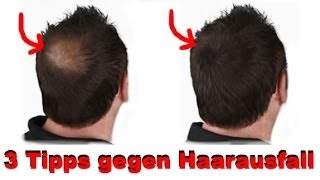 3 Tipps gegen Haarausfall [upl. by Aseram803]