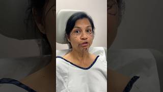 How Old is She 😳 Plastic Surgery Transformation facelift [upl. by Siderf169]