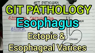 Ectopia amp Esophageal Varices  GIT Pathology [upl. by Jsandye]