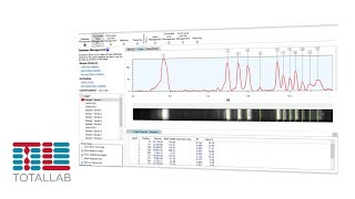 CLIQS 1D PRO  1D Gel Image Analysis Software  TotalLab [upl. by Jezabelle447]