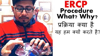 Ercp procedure video in Hindi [upl. by Davita]