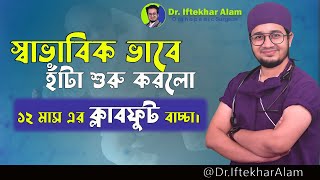 স্বাভাবিক ভাবে হাঁটা শুরু করলো ১২ মাস এর ক্লাব ফুট বাচ্চা । clubfoot DrIftekharAlam [upl. by Kaz]