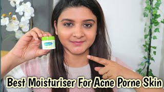 Best Moisturizer For Acne Prone SkinDry amp Sensitive Skin Cetaphil Moisturizing Cream Review [upl. by Risser]