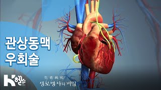 생로병사의 비밀 714회 핫클립👀  🔎관상동맥 우회술🔍 [upl. by Sivi]