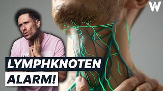 Unbekannte Knubbel Gefährlich von harmlos unterscheiden Wichtigsten Fakten zu großen Lymphknoten [upl. by Kurth]