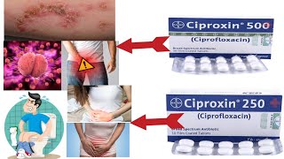 ciproxin 500 tablet uses in urdu ciproxin ciprofloxacin 250mg Side Effects Pregnancy Precautions [upl. by Casilda]