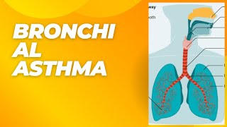 TOPIC15quotBRONCHIAL ASTHMA ITS SYMPTOMS DIAGNOSIS AND TREATMENT [upl. by Lucilla]