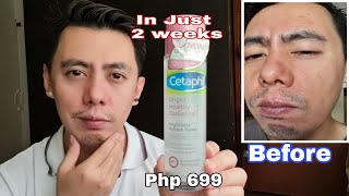 AFTER 2 WEEKS  CETAPHIL BRIGHTNESS WHITENING amp MO8STURIZIBG TONER REVIEW FOR ACNE SCARS OILY SKIN [upl. by Anesuza]