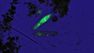 Freshwater ciliates stained acridine orange [upl. by Selassie982]