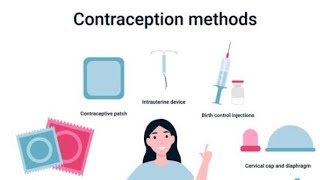 birth control method [upl. by Danielle]