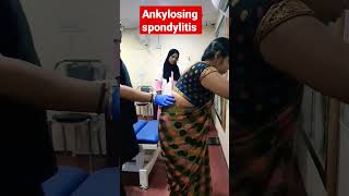 Ankylosing spondylitis treatment 93085113578409313131 drrajneeshkant [upl. by Jahdiel606]