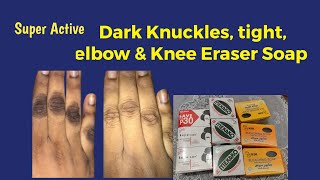 Super Effective Dark Knuckles tight elbow amp Knee Eraser Soap [upl. by Nomead]