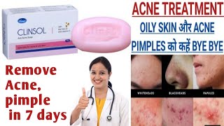 Clinsol Soap Uses or side Effects in Hindi Anti Acne Soap  कील मुंहासे को जड़ से खत्म करें [upl. by Alie259]