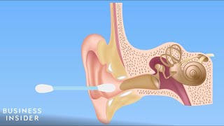 Forget QTips — Here’s How You Should Be Cleaning Your Ears [upl. by Rehsa]