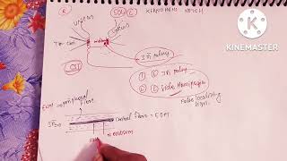 Brain herniation part 1kernohans notch phenomenonuncal herniation [upl. by Helena]