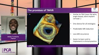 Contemporary appraisal of functional mitral regurgitation in the transcatheter era [upl. by Annunciata]