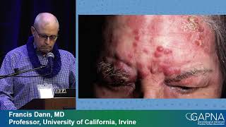 Treatment of Common Dermatologic Problems in Older Adults Preview [upl. by Eat]