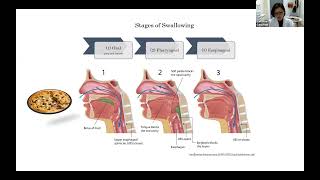 Swallowing Speech and Cognition in Parkinson’s Disease [upl. by Tiphani]