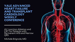 AV Junction Ablation and CRT for Patients with Permanent Afib and Narrow QRS [upl. by Grimbly50]