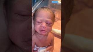 Newborn at Birth Video medical viralvideo [upl. by Zelazny]