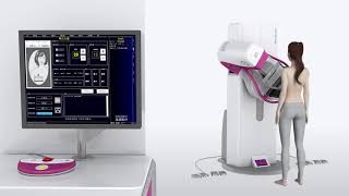 Sinomdt Tomosynthesis 3D Digital Mammography Machine Introduction [upl. by Yra962]