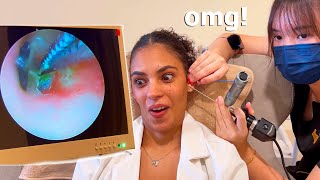 ASMR Deep Ear Cleaning with Tweezers to Remove Earwax [upl. by Luwana]