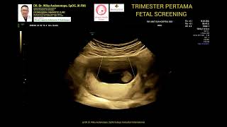 Trimester pertama Fetal Screening 14 weeks [upl. by Dasa]