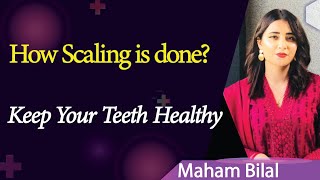 How Scaling is done   Teeth cleaning  Scaling and Polishing health teeth diet [upl. by Kaiulani348]