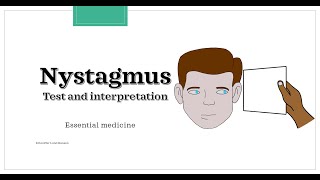 Nystagmus  test and interpretation Essential medicine [upl. by Jaddan]