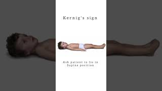 Kernig’s Sign kattrucate medicalreels medicalstudent headache neckpain meningitis sign [upl. by Mond192]