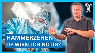 Hammerzehen natürlich behandeln Effektive Übungen für deine Fußgesundheit [upl. by Wittenburg]