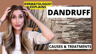 Dermatologist Explains Dandruff What Causes it amp Best Dandruff Treatments  Dr Sam Ellis [upl. by Naasah121]