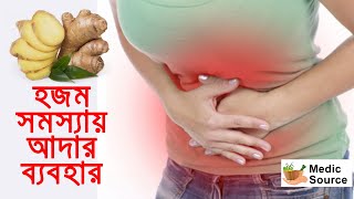 Hojom Shokti Baranor Upay  হজম শক্তি বাড়ানোর উপায় । Medic Source [upl. by Nomar926]