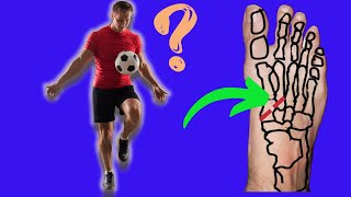 LISFRANC INJURY  When Can I RETURN TO SPORT [upl. by Bethany]