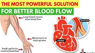 💗 The Most Powerful AllNatural Solution For Improving Your Blood Flow Circulation [upl. by Nylaras]