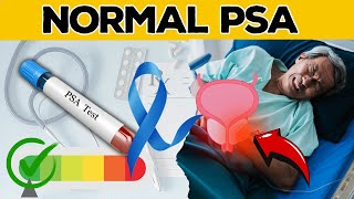 DO YOU KNOW What PSA is Normal for Man Without Prostate Cancer Lets Explore  Health Journey [upl. by Geilich]