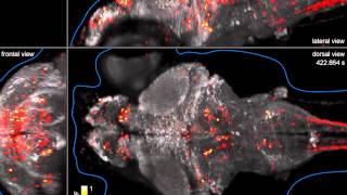 Wholebrain imaging of neuronal activity in a larval zebrafish [upl. by Hayes]