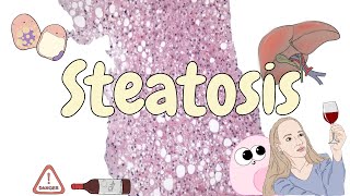 Steatosis  liver pathology [upl. by Kleeman]