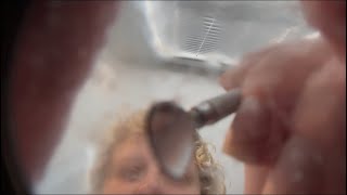 ASMR Scraping Dead Skin Off Your Face Actual Camera Touching [upl. by Atiuqer261]