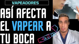 VAPEADORES o CIGARRILLOS ELECTRÓNICOS  Efectos de VAPEAR en tu BOCA [upl. by Dulcie]