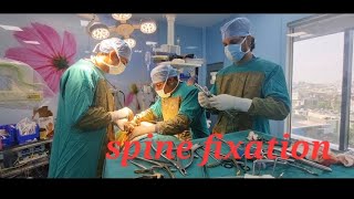 spine surgery spine fixation [upl. by Ericha]