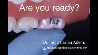 NuSmile Permanent Molar Crown Handson Workshop by Jorge Casián [upl. by Enirak]